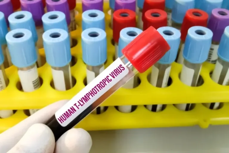 Ministério da Saúde Lança Orientações para Prevenção da Transmissão Vertical do HTLV