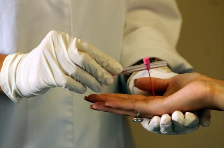 Mato Grosso Intensifica Luta Contra a Hanseníase: Ações da Secretaria de Saúde