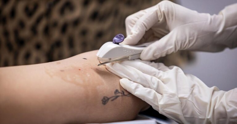 Avanço Histórico na Saúde da Mulher: Implanon Gratuito em Maceió