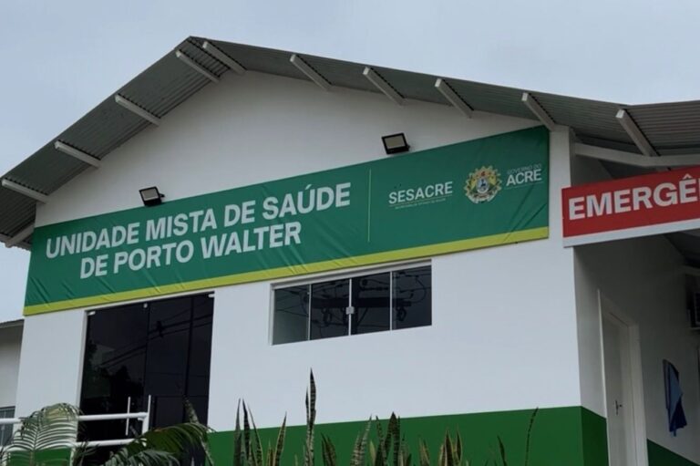 Avanços na Saúde: Raio-X Modernizado em Porto Walter Melhora Diagnósticos